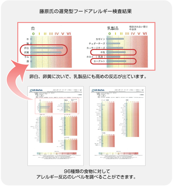 遅発型フードアレルギー検査結果