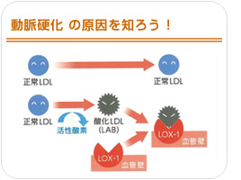 動脈硬化の原因を知ろう！